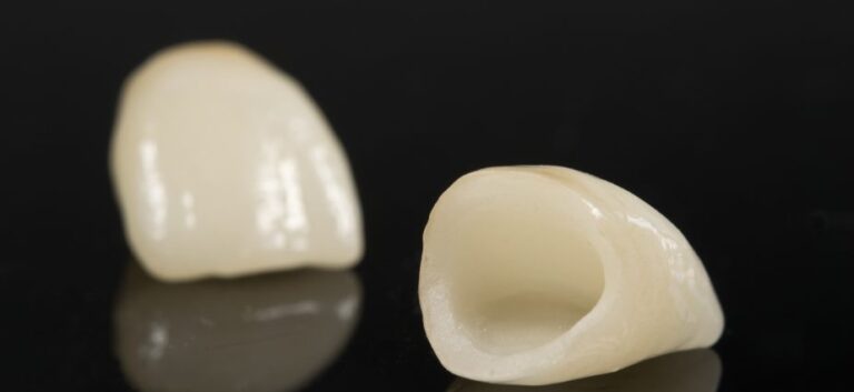 How Strong are Ceramic Crowns